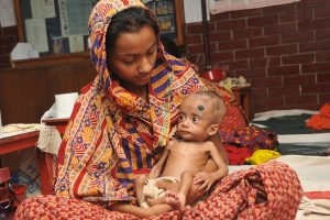 What is famine? Famine: meaning, causes and how to stop it